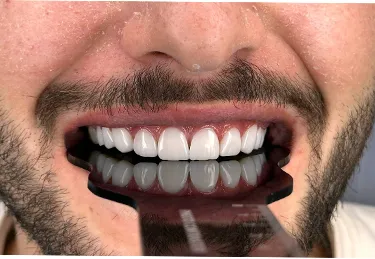 لبخند رضایت از کار دکتر عظیم زاده